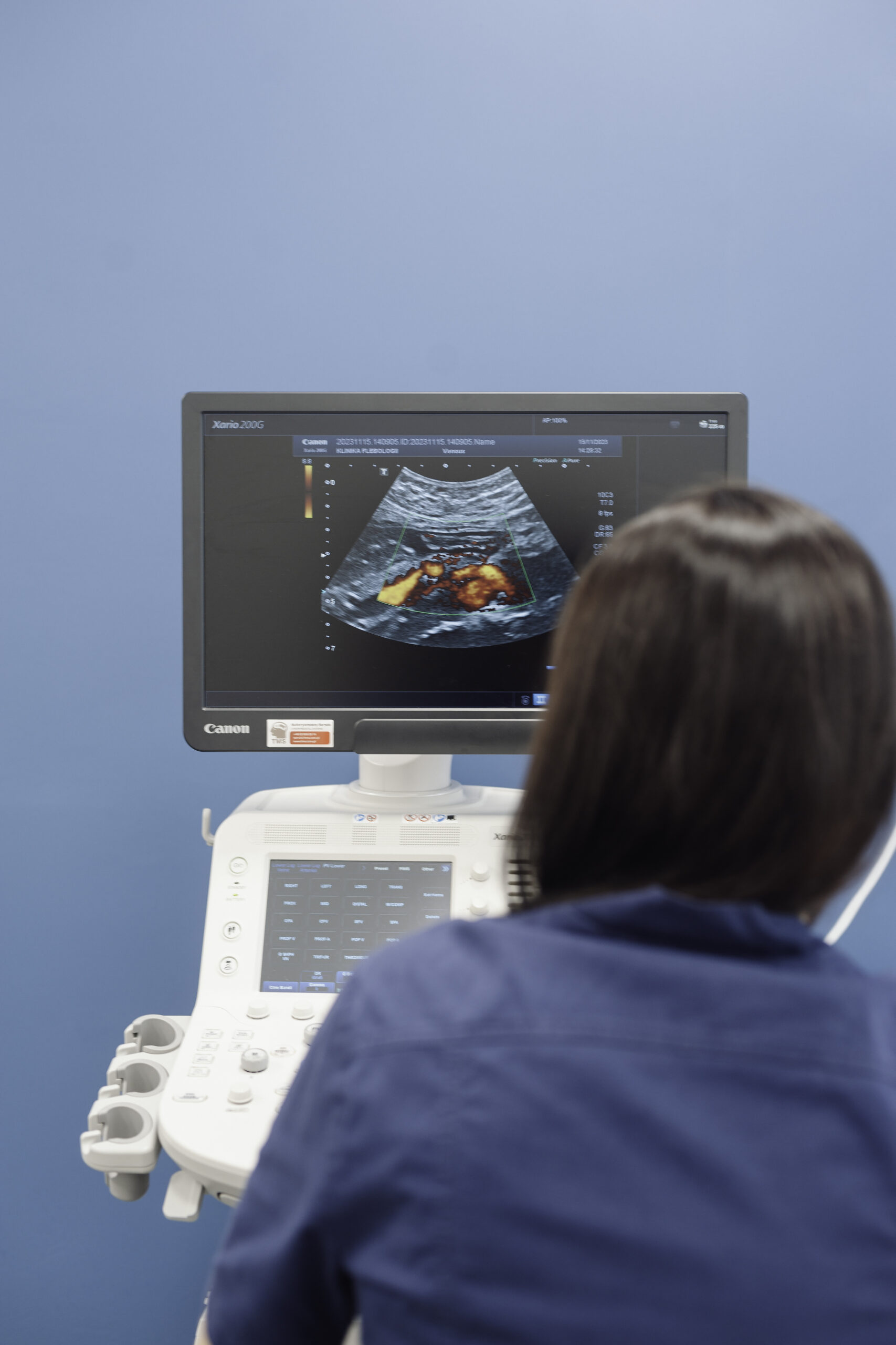USG Doppler – diagnostyka malformacji żylnych i ocenianie przepływu krwi. Specjalistyczne badania ultrasonograficzne w Klinice Flebologii.