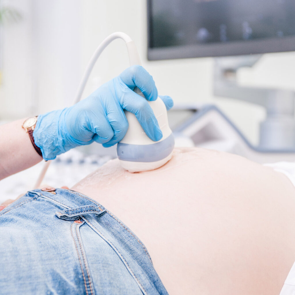 USG Doppler przez powłoki brzuszne wykonywane u ciężarnej.