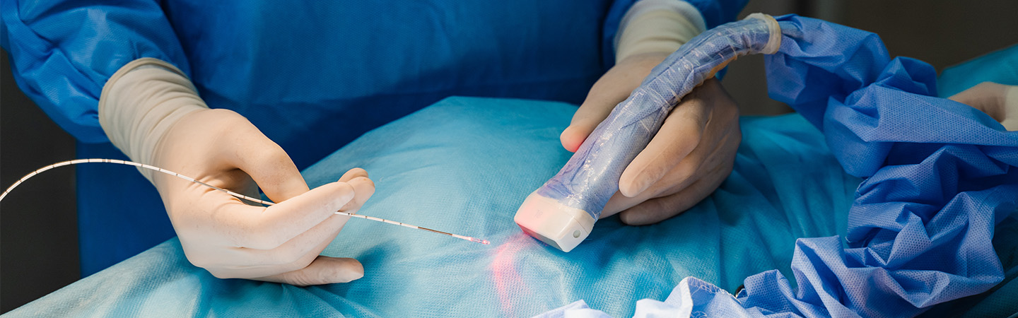 Laserowe usuwanie żylaków systemem ELVeS 1470. Klinika Flebologii