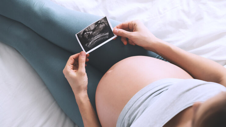 Kobieta w ciąży z wynikiem badania USG. Żylaki okolic intymnych.