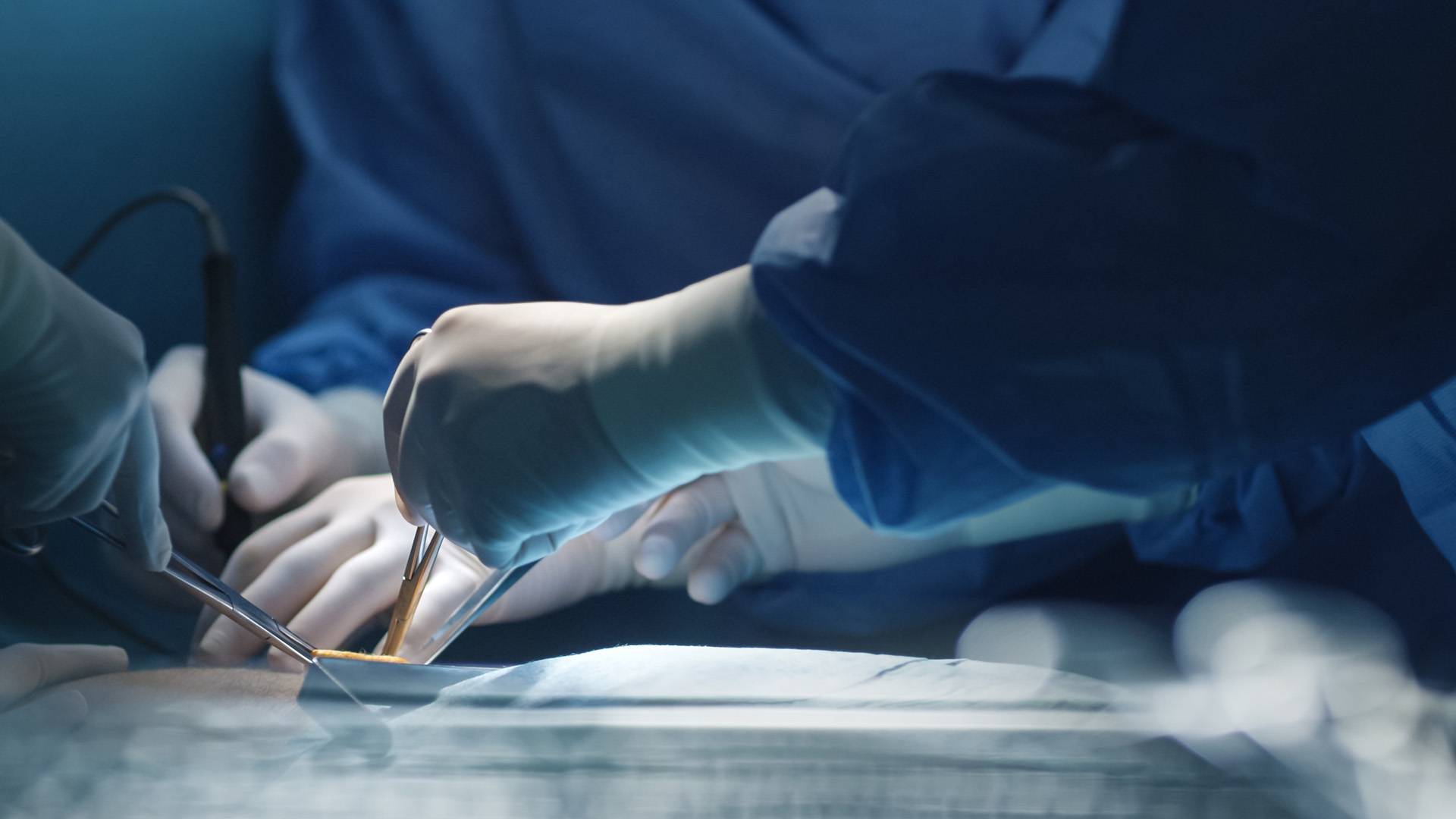 Safenektomia. Chirurgiczne leczenie żył.