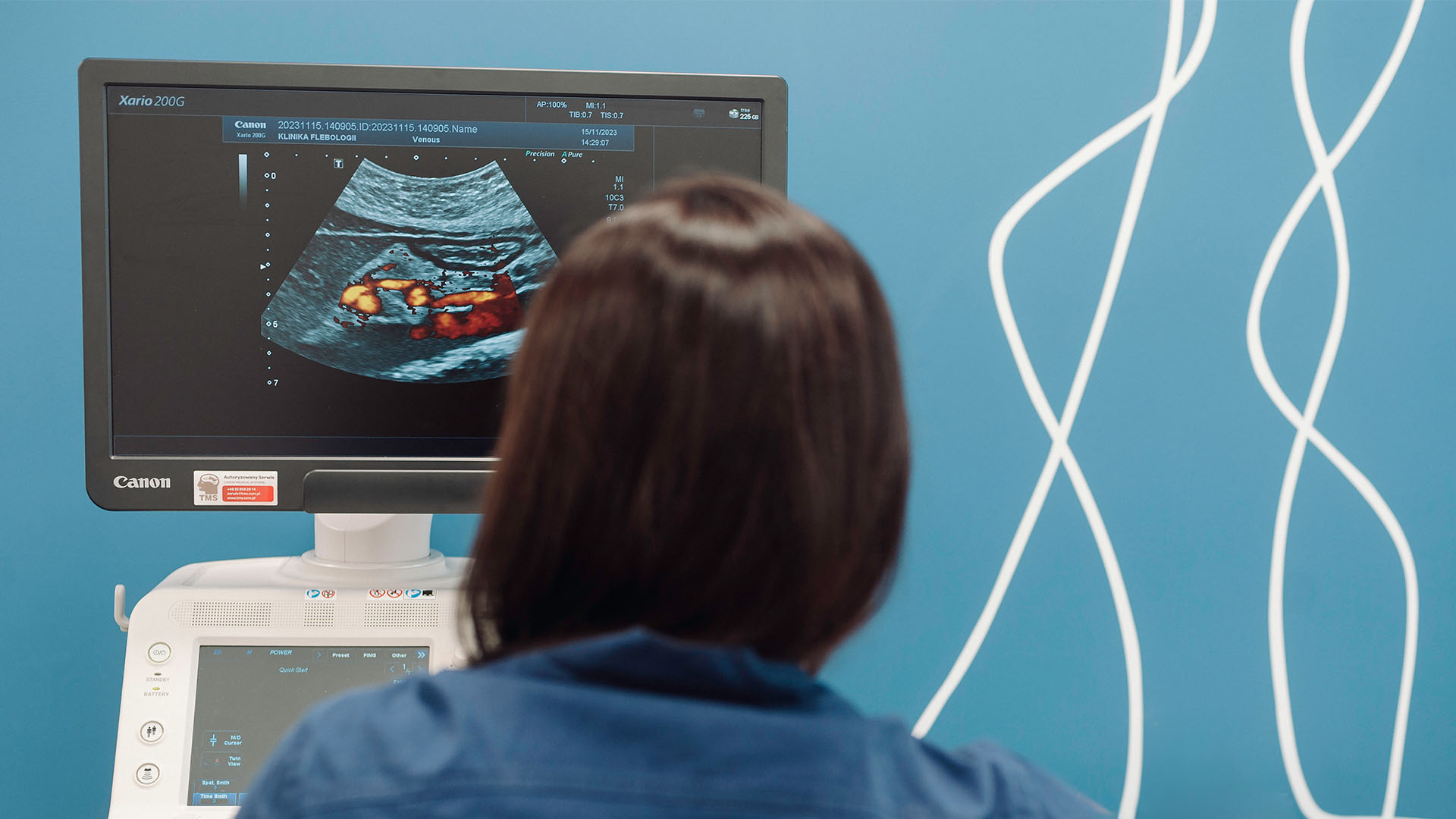 USG Doppler. Klinika Flebologii