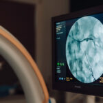 Flebografia na aparacie Zenition 70 w Pracowni Naczyniowej Kliniki Flebologii.