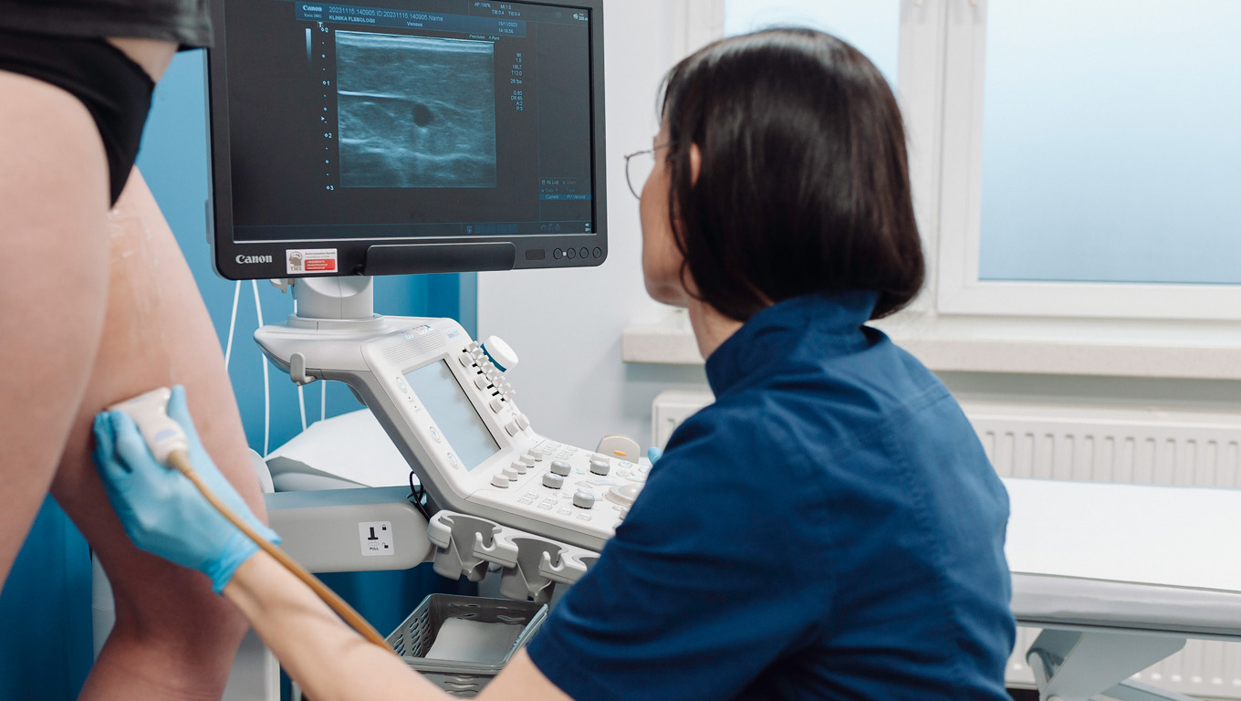 Konsultacja flebologiczna z USG Doppler żył.