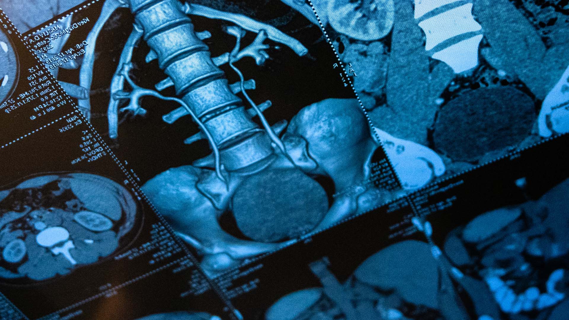konsultacja radiologiczna. Klinika Flebologii