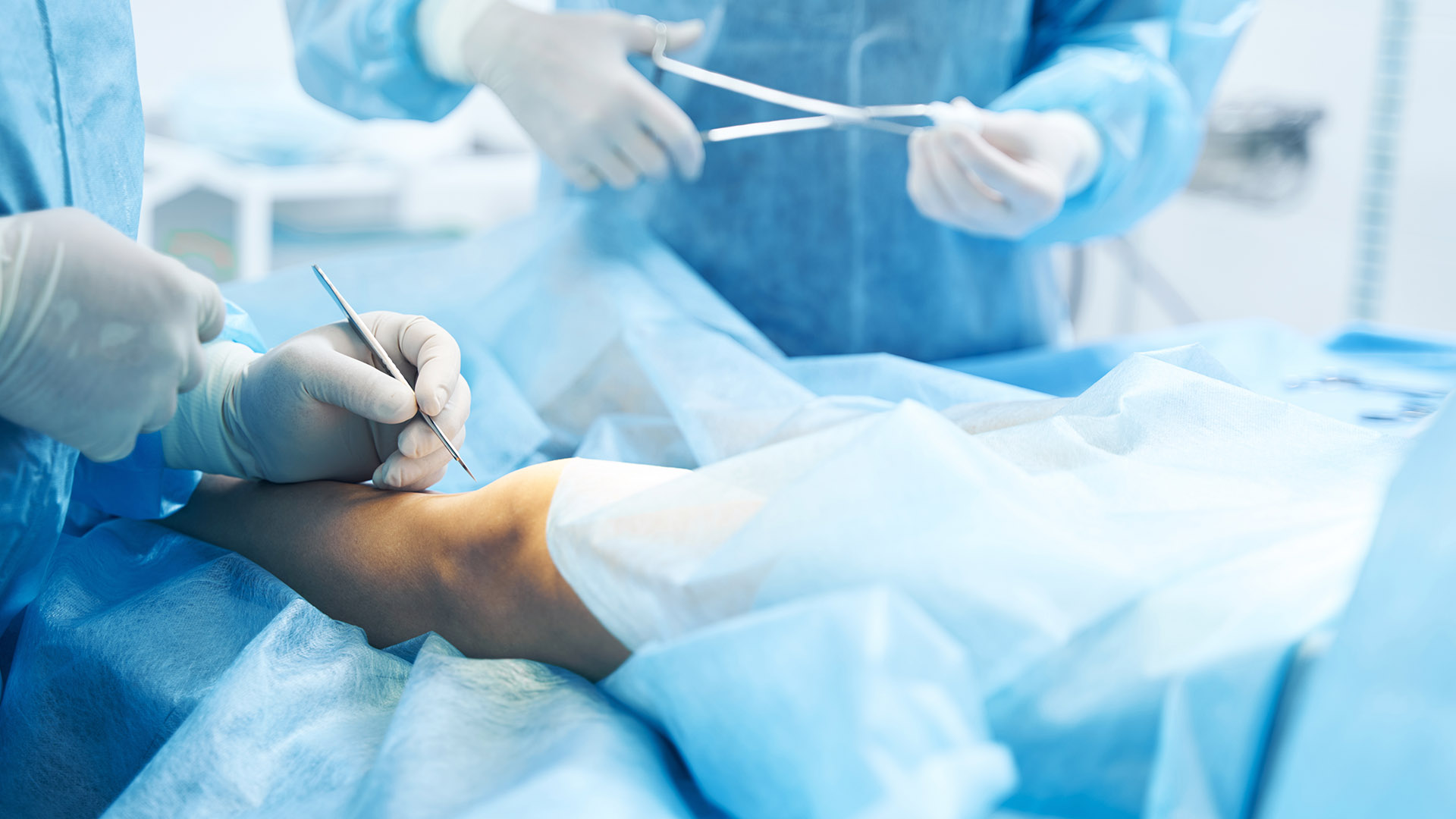 Miniflebektomia żylaków. Chirurgia żył.