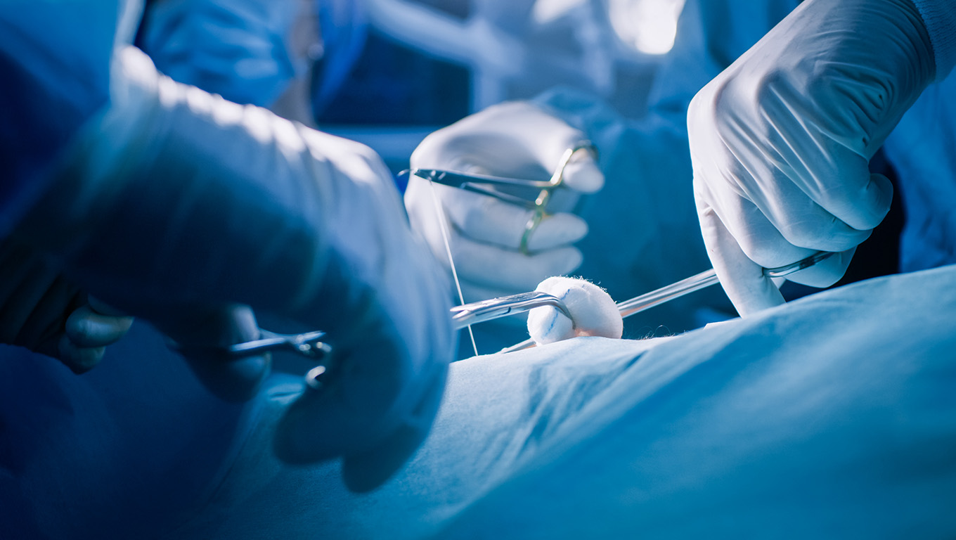 Safenektomia. Żylaki - leczenie chirurgiczne.