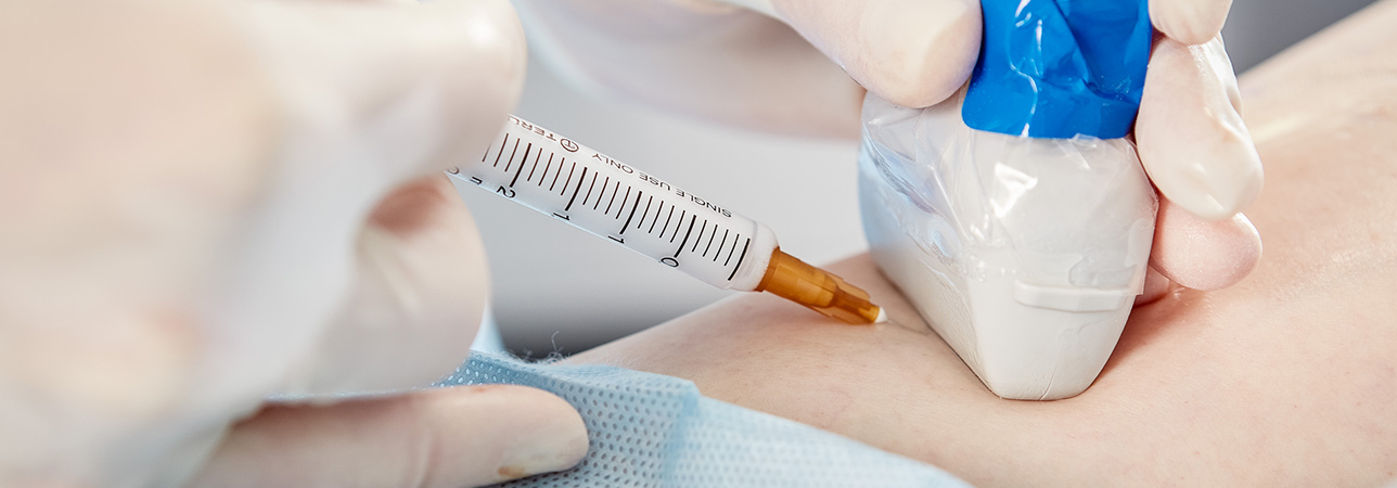 Echoskleroterapia wykonywana w Klinice Flebologii.