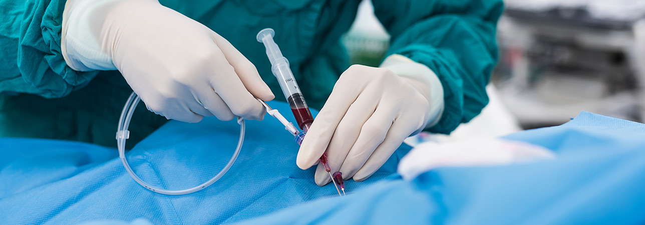 Zakładanie dostępu naczyniowego.