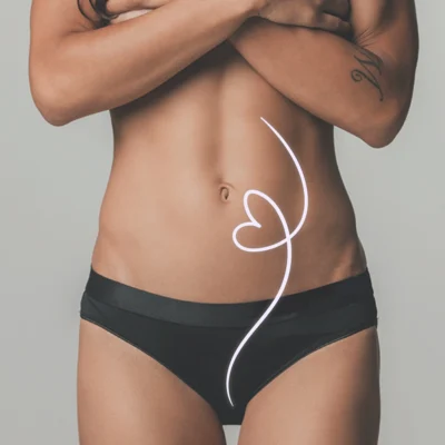 Znak serca na przebiegu lewej żyły jajnikowej na ciele nagiej kobiety.